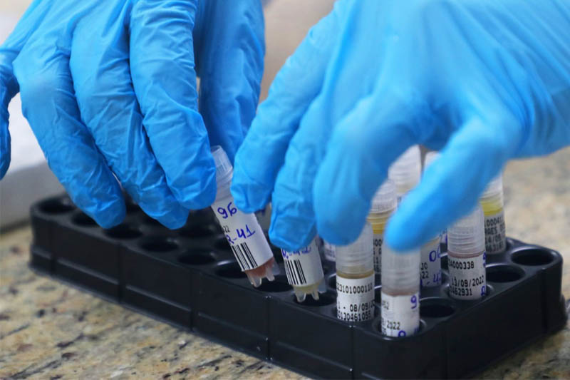 Cerca de 1,2 milhão de testes para detecção da Covid-19 venceram no mês de março no estoque do Ministério da Saúde.