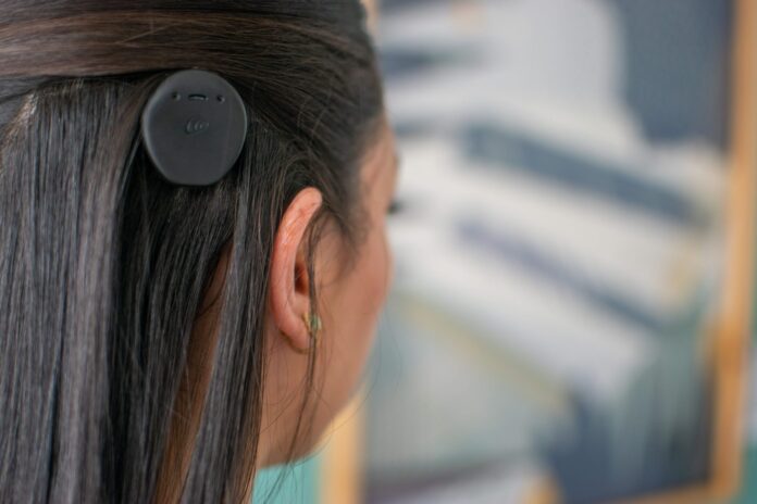 Implantes Cocleares são uma opção para reversão de perda de audição severa