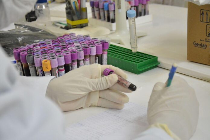 O AM se destaca como o 3º estado que mais compartilha material biológico de restos mortais não identificados com o Banco Nacional.