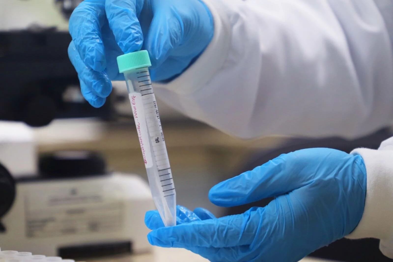 A FVS-RCP, vinculada à Secretaria de Estado de Saúde, divulgou o informe epidemiológico semanal sobre a mpox no estado.