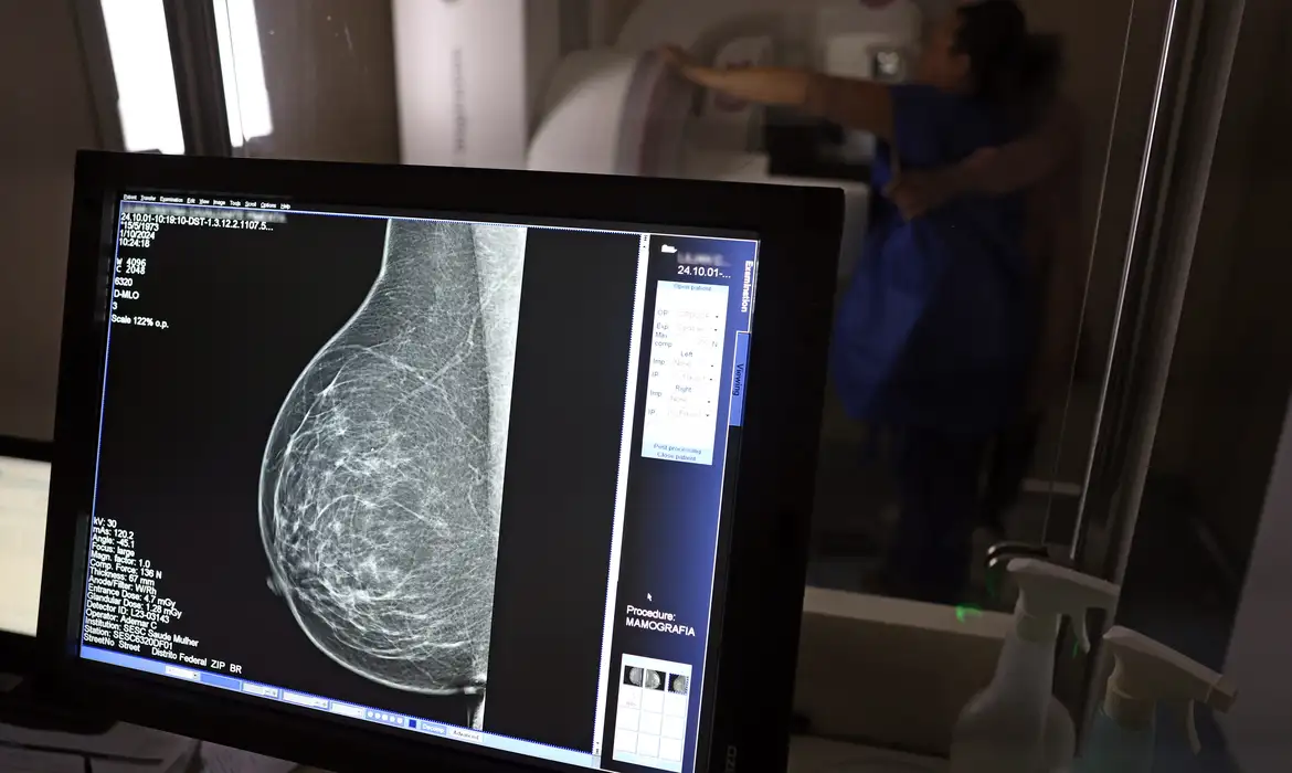 Ministério da Saúde passa a recomendar mamografia a partir dos 40 anos