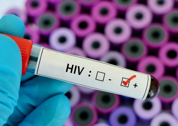 Entre 2007 e 2023, o Amazonas registrou 3.829 mortes por Aids, segundo um estudo realizado por pesquisadores do estado.