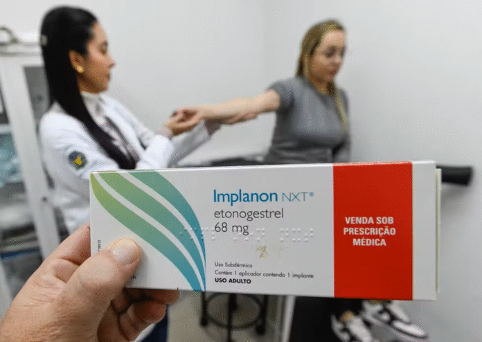 A partir de janeiro, o Implanon estará disponível em Manaus. Entenda como funciona o novo implante contraceptivo do SUS, quem pode usar e onde encontrar.