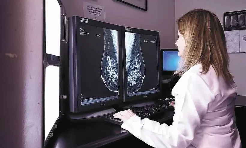 A suspensão dos exames de Mamografia em Parintins, no Hospital Jofre Cohen, preocupa. Vereadora cobra da prefeitura a retomada urgente