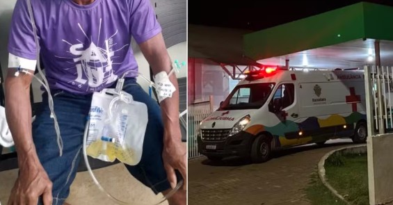 Agricultor de 50 anos sobrevive após ser atingido por um raio dentro de casa na zona rural de Itacoatiara, no Amazonas.