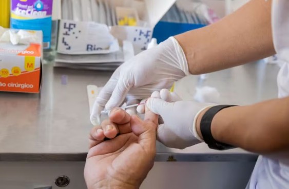 Manaus lança Dezembro Vermelho após registrar 1.298 novos casos de HIV. Ação oferece testes, PrE e, distribuição de preservativos.