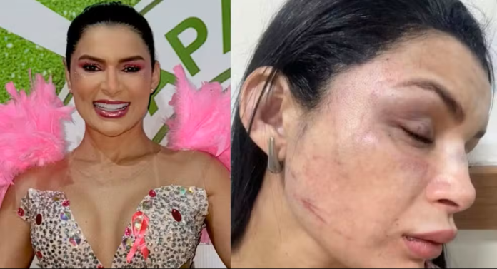 Um falso motorista de aplicativo foi preso em Manaus após agredir a musa Marcia Santos. Entenda a dinâmica do crime e a ação da Polícia Civil.