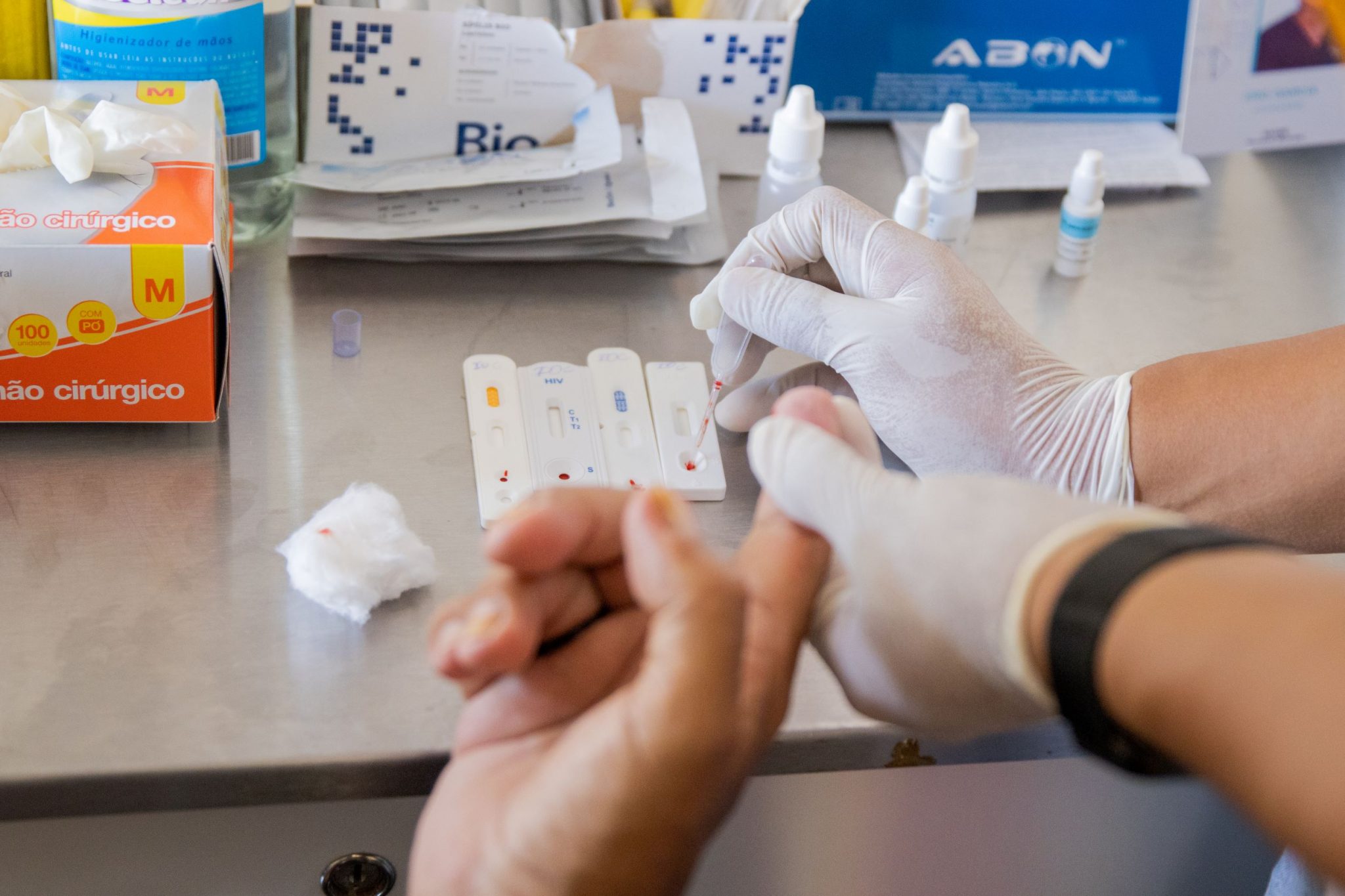 O Circuito Rápido foi implantado em Manaus para combater a mortalidade por HIV. Saiba como a estratégia agiliza exames e tratamentos na rede pública de saúde.