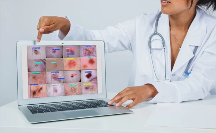 Modelo de IA no diagnóstico de câncer de pele atinge 80% de sensibilidade e pode reforçar triagem no SUS em regiões sem especialistas.