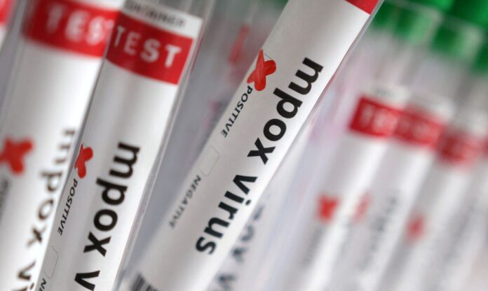 Casos de Mpox no Brasil chegam a 140 em 2026