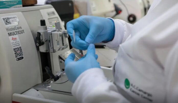O SUS incorporou o tratamento de leucemia mieloide aguda para adultos.