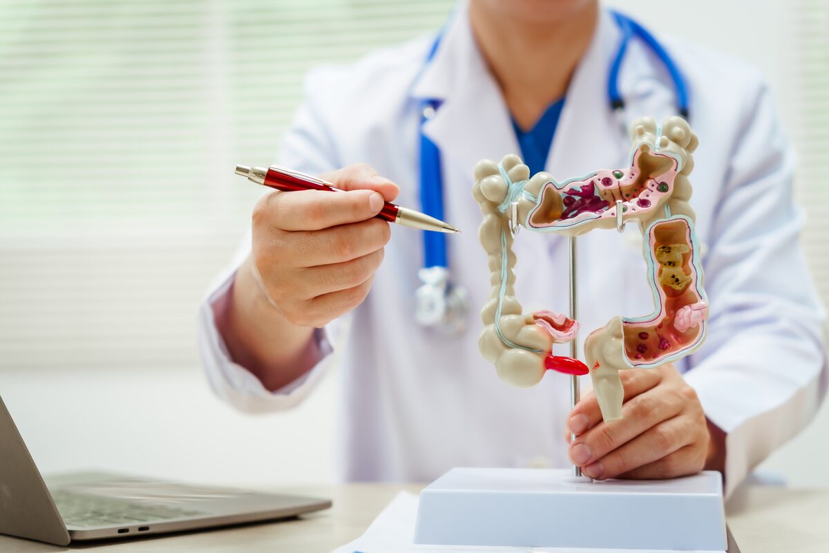 SUS inclui teste FIT para rastreamento de câncer colorretal. Exame busca sangue oculto em pacientes de 50 a 75 anos para detecção precoce da doença.