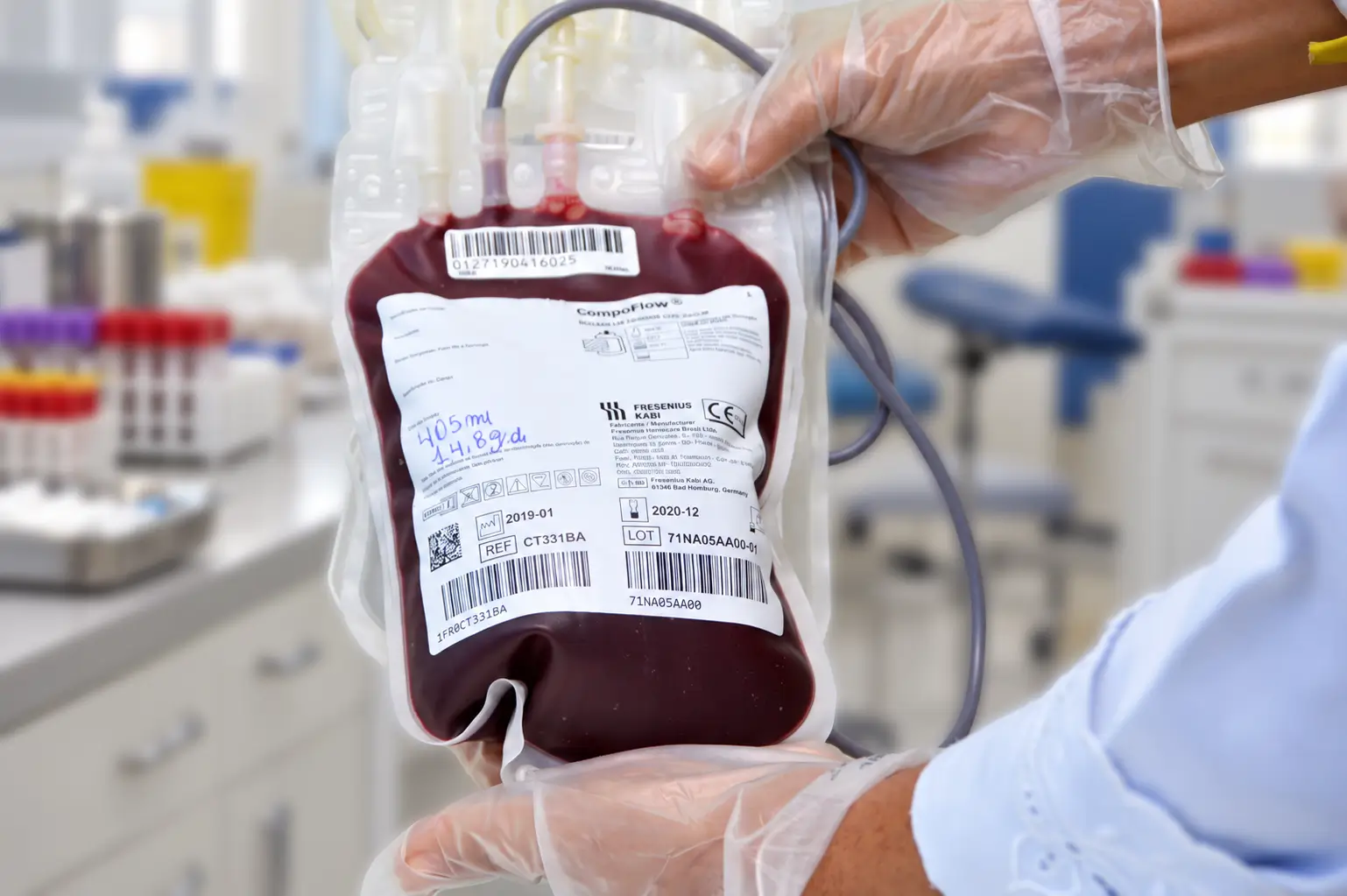 Hemoam registra queda de 40% nas doações de sangue no Amazonas e convoca voluntários para manter os estoques abastecidos.